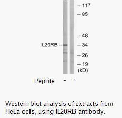 Product image for IL20RB Antibody