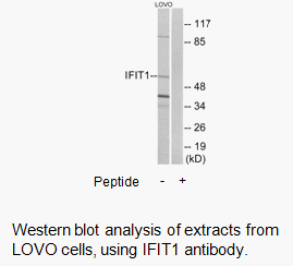 Product image for IFIT1 Antibody