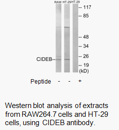 Product image for CIDEB Antibody