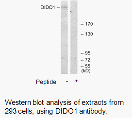 Product image for DIDO1 Antibody