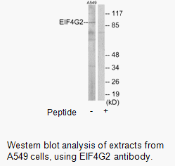 Product image for EIF4G2 Antibody
