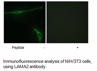 Product image for LAMA2 Antibody