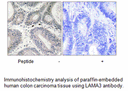 Product image for LAMA3 Antibody