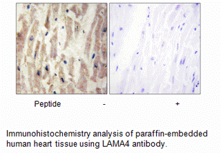 Product image for LAMA4 Antibody
