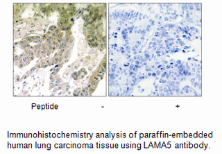 Product image for LAMA5 Antibody