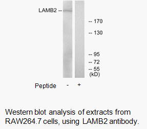 Product image for LAMB2 Antibody