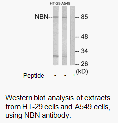 Product image for NBN Antibody