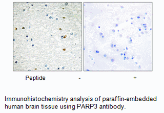Product image for PARP3 Antibody
