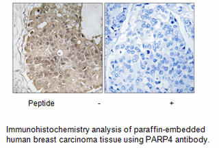 Product image for PARP4 Antibody