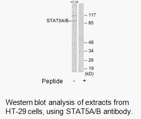 Product image for STAT5A/B Antibody