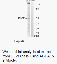 Product image for AGPAT5 Antibody