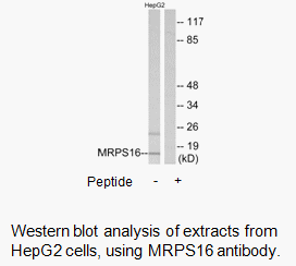 Product image for MRPS16 Antibody