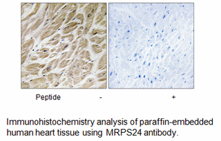 Product image for MRPS24 Antibody
