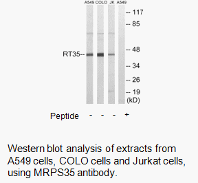 Product image for MRPS35 Antibody