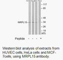Product image for MRPL15 Antibody