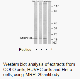 Product image for MRPL20 Antibody