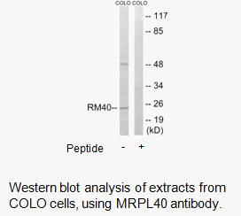 Product image for MRPL40 Antibody