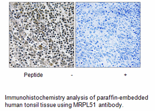 Product image for MRPL51 Antibody