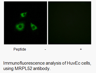 Product image for MRPL52 Antibody