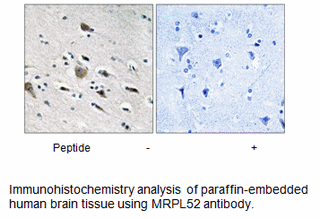 Product image for MRPL52 Antibody