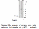 Product image for RPS11 Antibody