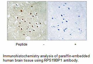 Product image for RPS19BP1 Antibody