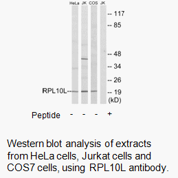 Product image for RPL10L Antibody