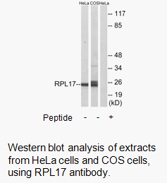 Product image for RPL17 Antibody