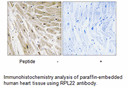 Product image for RPL22 Antibody