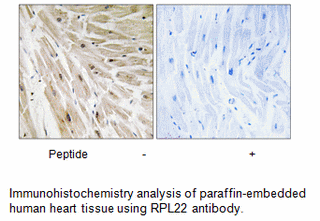 Product image for RPL22 Antibody
