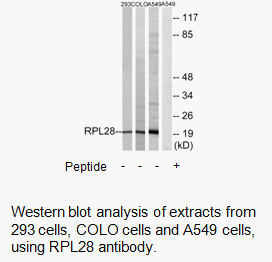 Product image for RPL28 Antibody