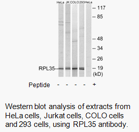 Product image for RPL35 Antibody