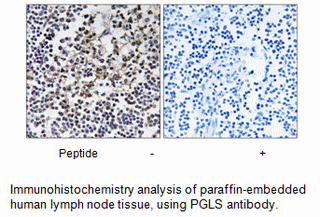 Product image for PGLS Antibody