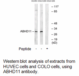 Product image for ABHD11 Antibody