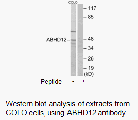 Product image for ABHD12 Antibody