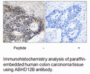 Product image for ABHD12B Antibody