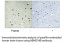 Product image for ABHD14B Antibody