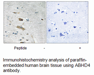Product image for ABHD4 Antibody