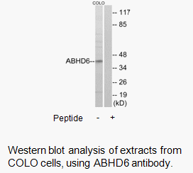Product image for ABHD6 Antibody