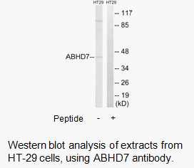 Product image for ABHD7 Antibody
