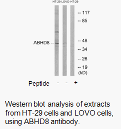 Product image for ABHD8 Antibody