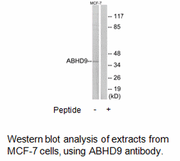 Product image for ABHD9 Antibody