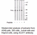 Product image for ACAT1 Antibody