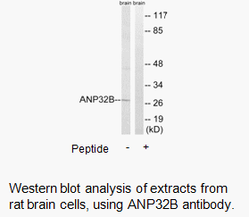 Product image for ANP32B Antibody