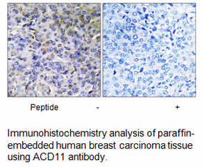 Product image for ACAD11 Antibody