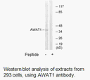 Product image for AWAT1 Antibody