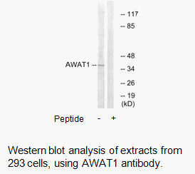 Product image for AWAT1 Antibody