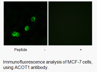 Product image for ACOT1 Antibody