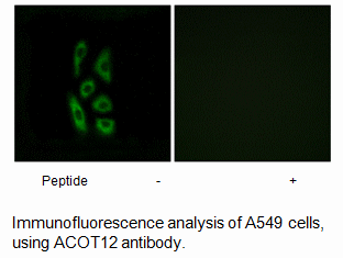 Product image for ACOT12 Antibody