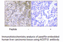 Product image for ACOT12 Antibody